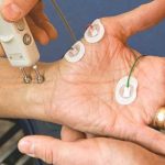 نوار عصب و عضله - الکترومیوگرافی