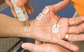 نوار عصب و عضله - الکترومیوگرافی