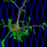 محقق ایرانی دانشگاه پنسیلوانیا راهی تازه برای مبارزه با سرطان سینه پیدا کرد 5 پروتئین سرطان سینه