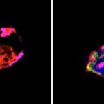 کمتر از 7 ساعت خواب شبانه احتمال بیماری قلبی را افزایش میدهد 2 کمتر از 7 ساعت خواب شبانه احتمال بیماری قلبی را افزایش میدهد
