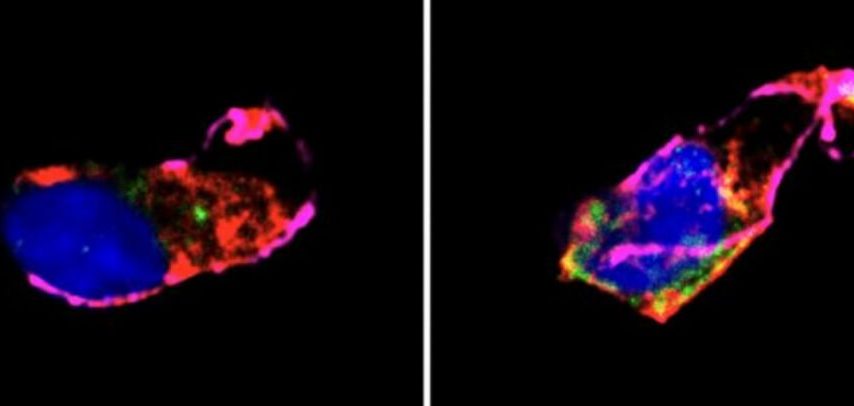 کمتر از 7 ساعت خواب شبانه احتمال بیماری قلبی را افزایش می‌دهد