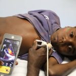 روماتیسم قلبی؛ از علت تا درمان و پیشگیری 8 شخیص روماتیسم قلبی با ابزارهای پزشکی