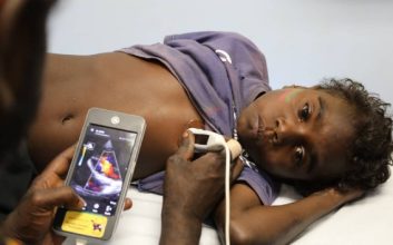 شخیص روماتیسم قلبی با ابزارهای پزشکی