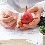 پزشک در حال توضیح روند سیستوسکوپی روی مدلی از مثانه