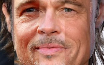 پرد پیت مبتلا به چهره کوری است