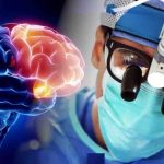 بیوپسی مغزی برای تشخیص آمیب مغزحوار