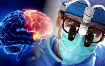 بیوپسی مغزی برای تشخیص آمیب مغزحوار