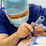 پزشک در حال انجام لارنگوسکوپی