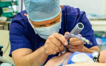 پزشک در حال انجام لارنگوسکوپی