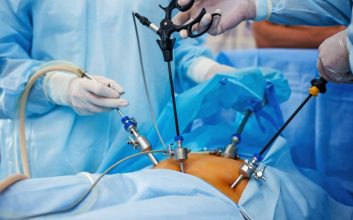 پزشکان در حال انجام عمل لاپاراسکوپی