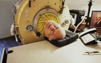 مردی پس از 70 سال زندگی با «ریه آهنی» درگذشت