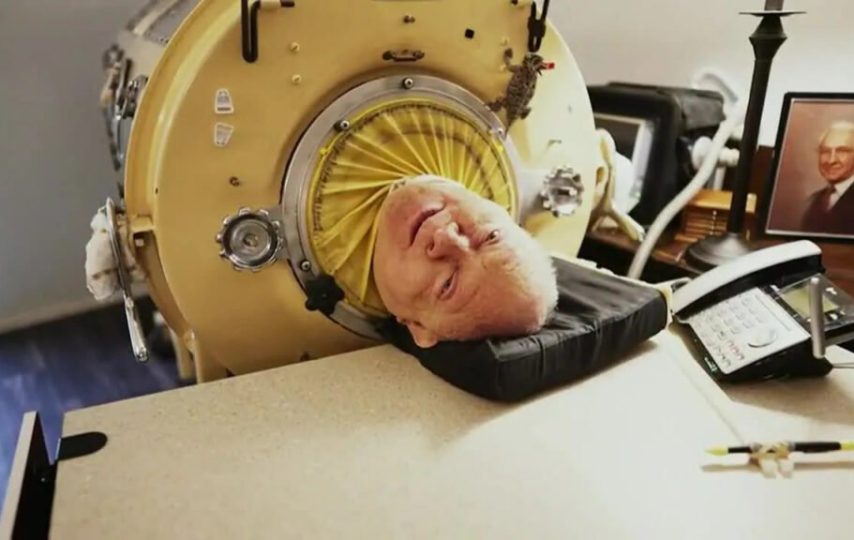 مردی پس از 70 سال زندگی با «ریه آهنی» درگذشت