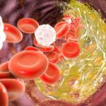 اچ دی ال کلسترول