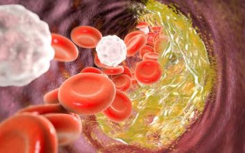 اچ دی ال کلسترول