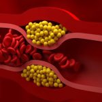 کلسترول بد خون به شکل دایره‌های زردرنگ