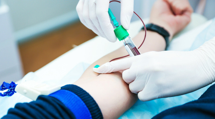 الیگومنوره؛ آنچه باید درمورد قاعدگی نامنظم بدانید_دنیای تکنولوژی 6 الیگومنوره - آزمایشهای مربوط به الیگومنوره