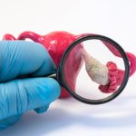 بررسی تخمدان با ذره‌بین