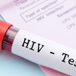 داروی جدید پیشگیری از HIV در آزمایش‌ها اثربخشی 100 درصدی نشان داد