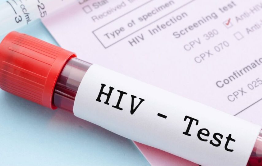 داروی جدید پیشگیری از HIV در آزمایش‌ها اثربخشی 100 درصدی نشان داد