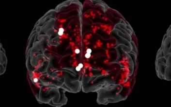 دانشمندان مدارهای عصبی مرتبط با خلاقیت در مغز را کشف کردند