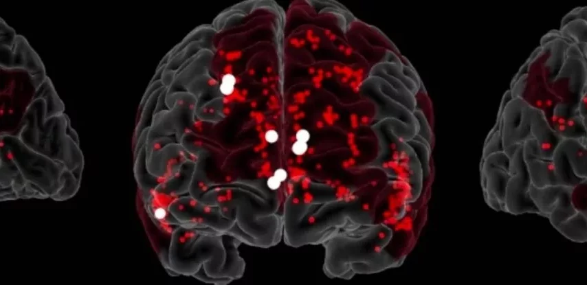دانشمندان مدارهای عصبی مرتبط با خلاقیت در مغز را کشف کردند
