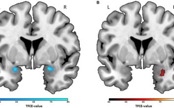 ژانر فیلم مورد علاقه شما چه اسراری از مغزتان فاش می‌کند؟