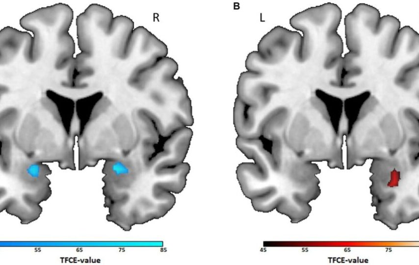 ژانر فیلم مورد علاقه شما چه اسراری از مغزتان فاش می‌کند؟