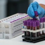 دانشمندان یک سیستم گروه خونی تازه کشف کردند_دنیای تکنولوژی 2 سیستم گروه خونی