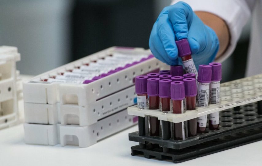 سیستم گروه خونی