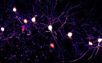 تصویر نورون‌ها و شاخه‌های آن‌ها به نام دندریت در قشر مغز موش