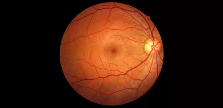 رگ‌های چشم شاید بتواند به تشخیص زودهنگام زوال عقل کمک کند