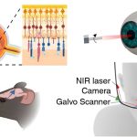 تزریق نانوذرات طلا به چشم!_دنیای تکنولوژی 6 تزریق طلا به چشم برای درمان نابینایی