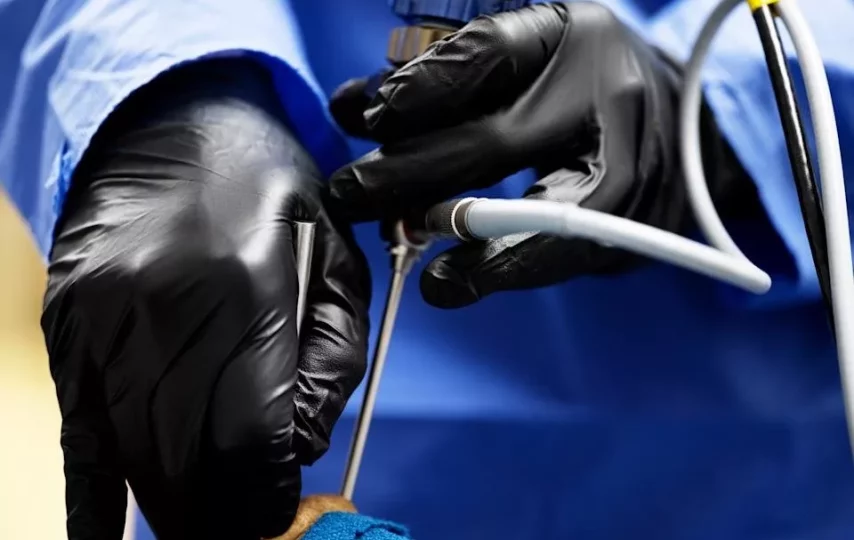 خارج‌کردن تومور نخاعی از طریق چشم