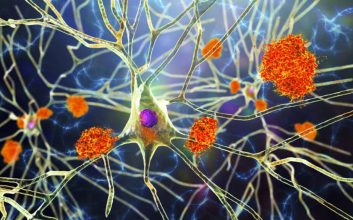 چرا بیماری‌ها بر زنان و مردان اثر متفاوتی دارند؟ تحقیق جدید پاسخ می‌دهد