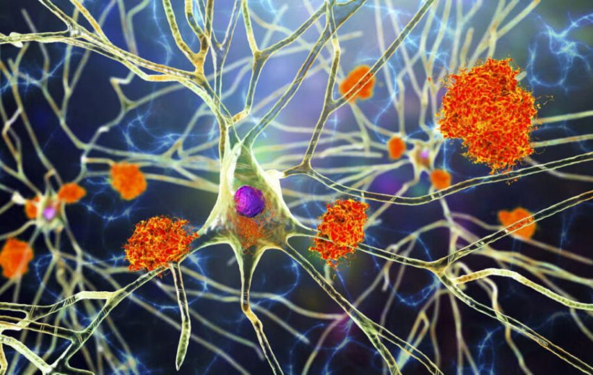 چرا بیماری‌ها بر زنان و مردان اثر متفاوتی دارند؟ تحقیق جدید پاسخ می‌دهد