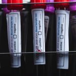 ویروس کرونا