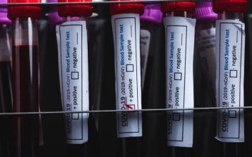 ویروس کرونا