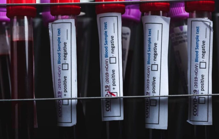 ویروس کرونا